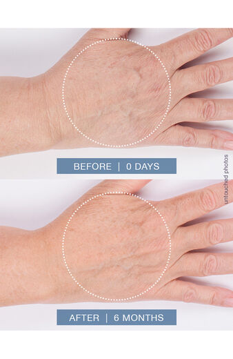 Clearance Hand & Cuticle Treatment Cream