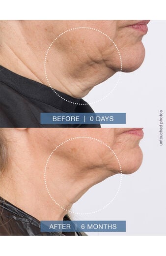 Clearance Face Treatment Cream