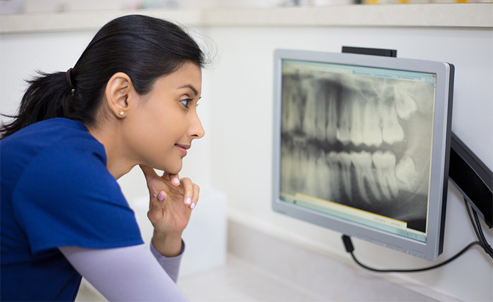 dental assistant examining dental x-ray at dentist office